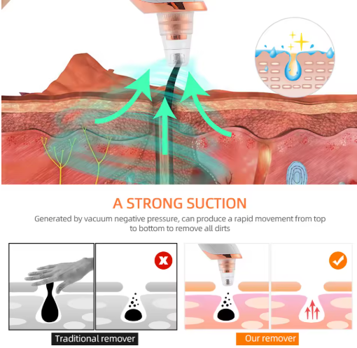 Pore Cleaner with camera